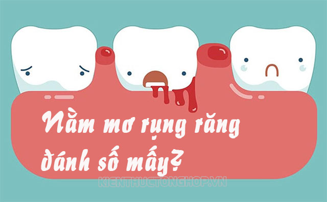 Mơ thấy rụng răng không có máu: Điềm báo gì? Giải mã giấc mơ